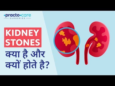 What Are the Causes & Symptoms of Kidney Stones? | गुर्दे की पथरी के कारण और लक्षण | Practo