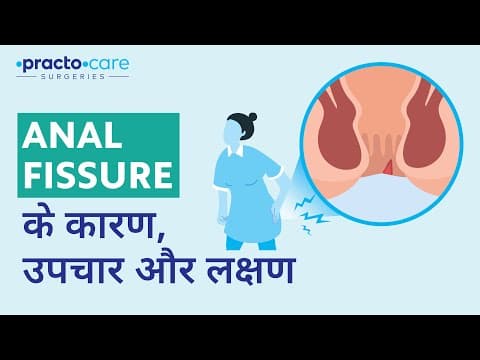 Anal Fissure: Causes & Symptoms | What is Anal Fissure (In Hindi)? | Practo