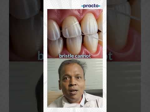 Is Brushing Enough? Why You Still Need to Floss! A Dentist Explains #practo #shorts