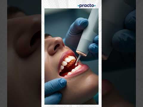 Braces vs Aligners: Which One Is Right for You? A Dentist Explains. #shorts #practo
